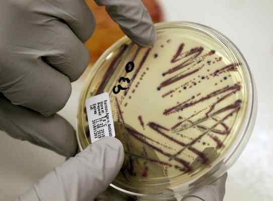 CDC Issues Warning Of E. Coli Outbreak Linked To Beef